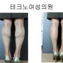 식약청 인증 PDO실로 처진 볼살 탱탱하게 10년 젊어져보세요..목주름 팔자주름 뱃살 등살 종아리 축소까정 효과 탁월함니다.. 이미지