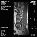 엠알아이 이미지