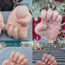 매료네일 문제성전문점 | 압구정 물어뜯는 손톱 연장 문제성 손톱 관리 이홍진네일 후기