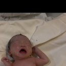 에디스 | 부산 에디스여성병원 제왕절개 후기 1일차