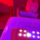 호박동물병원 | 강남 무쌍 쌍수 (절개, 눈매교정, 지방제거) 리얼후기 성형외과 광고X