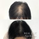 에이치뷰티 이미지