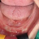 여치과기공소 이미지