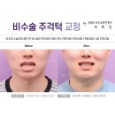 뉴욕본치과