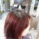 설이헤어라인 이미지