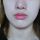 샛별마사지 이미지