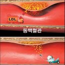 에이치디엘 이미지