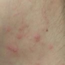 큰열매여성의원 | 30대에스트로겐 영양제 여성호르몬 추천 후기