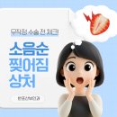 반포산부인과 잦은 소음순 찢어짐 상처, 무작정 수술 전 체크!