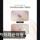 스카이라인의원 | 서울 강남 논현동 성형외과 추천 스카이라인의원 스카이라인의원, 부작용 최소화