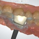 R - Dental 티스토리