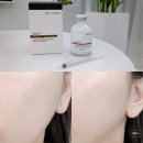 씨에스디바 | 에스테틱화장품 바쿠나 앰플 피부관리실 유명템