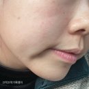 이지마트 | 향남 피부관리 이지에스테틱 솔직후기