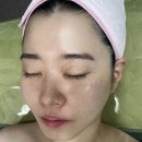 모공 케어 주름 케어 탄력 리프팅, 환절기 피부가 고민이라면? 올가드림뷰티 하대원점
