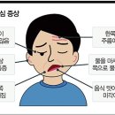 소리 없이 찾아오는 안면마비 이미지