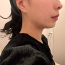 다있네가구 - 사상구 사상로 569 | 내돈내산 대구피부과 온다리프팅 인모드 2차 추천 후기