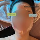 왕십리 피부관리 주다spa (왕십리 에스테틱 고주파 리프팅)