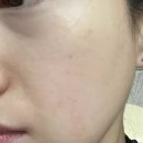 피부숨쉬다 이미지