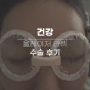 지티타워약국 | 강남 ㅂㅇㅂ안과에서 올레이저 라섹 후기 두 번째 :: 수술 당일의 기록(재업로드)