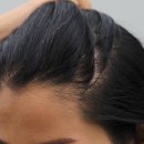 수헤어라인 이미지