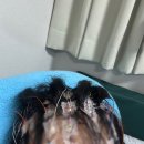 오진으로 2년간 뇌전증 약 먹은 썰｜뇌전증 증상·약물 부작용·비디오뇌파검사 후기