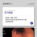 송*옥