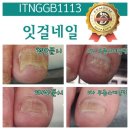 잇걸네일 이미지