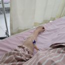 연세모아 병원 버스정류장 | 거대 자궁근종 다빈치로봇수술 후기_연세사랑모아