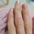 와우펫 | 고양이 상처 관리 "이노트(INOT) 펫도씨(PET'C) 와우 스프레이" 후기