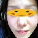 정내과 네이버블로그