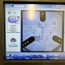 타르트옵티컬 | <다초점 전문 다산안경> 타르트옵티컬 뿔테 &amp; 바리락스 다초점 렌즈 상담 후기