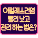 가은한의원 | 만성 아킬레스건염 증상, 치료 후기!