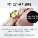 골드크라운