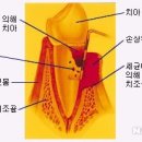 투명한치과 네이버블로그