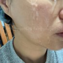 엠원코리아 | 이오시카 M1(엠원) 올인원 피부관리기 풀세트 구매후기