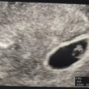 신세계병원산후조리원 이미지