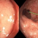 OK큐병원 화장실 이미지