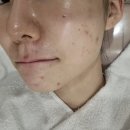 구암동630 | 대전 유성 피부관리 굳이 이유 에스테틱까지 다녀온 후기