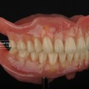 청주하나치과기공소 이미지