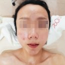 연당원장애인화장실 | 마포피부관리 오뽐 에스테틱 시그니처 윤곽관리 후기