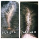볼빅 탈모샴푸 체험 후기