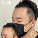 프로스칼프부산 이미지