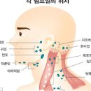 임파선염 방치하면 더 심해져요 이미지