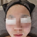 미더베스트마곡점 | 서울 강서구 마곡동 마곡피부관리 미더베스트마곡점 솔직후기
