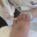 레푸스 | 당진무좀 발톱 스케일링 내성발톱 관리 당진 레푸스 후기