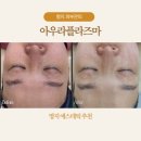 명지 피부관리 아우라플라즈마에서 받은 스페셜케어 후기 혈류순환 윤곽개선까지