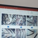 구로두피 탑스칼프 구로디지털점 탈모 고민이라면