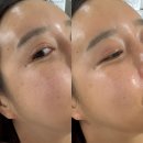 쫀쫀한 피부를 위한 피부탄력앰플 추천 메이리 펩타이드 앰플
