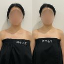 1656 | 울산윤곽관리 피부온결, 울산 유일 유경테라피가 있는 곳 솔직후기