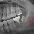 호평나무치과의원 이미지